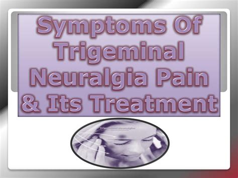 PPT - Symptoms Of Trigeminal Neuralgia Pain & Its Treatment PowerPoint