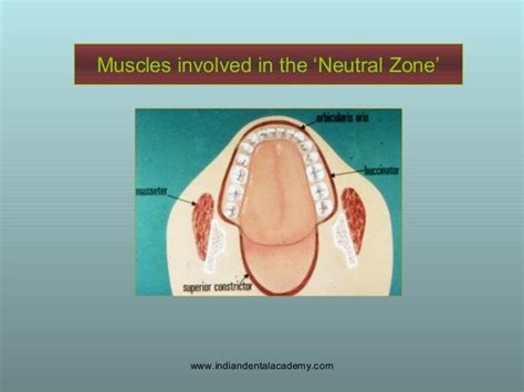 Concept Of Neutral Zone Dental Seminars