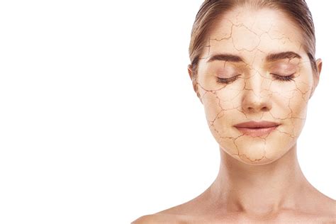 7 Safe Ingredients For Dry Skin | LearnSkin