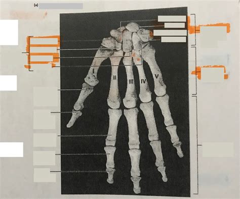 Skeleton Lab Practical Right Wrist And Hand Anterior View Diagram