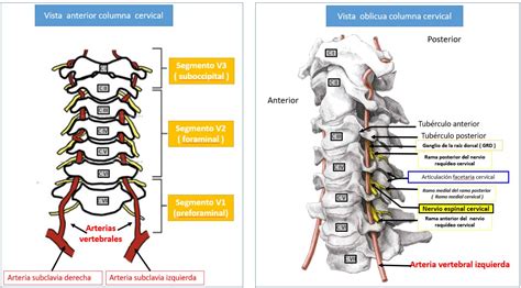 Arterias Vertebrales Dolopedia