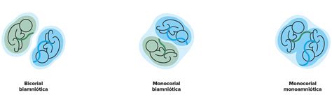 ¿qué Es El Síndrome De Transfusión Feto Fetal PortalclÍnic