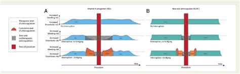 Figure 1 From Heparin Bridging In Peri Procedural Management Of New