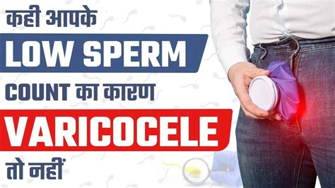 कही आपके Low Sperm Count का कारण Varicocele तो नहीं What Causes Low