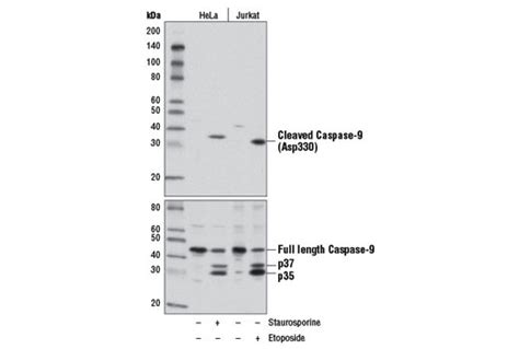 Cleaved Caspase 9 Asp330 D2d4 Rabbit Mab Cell Signaling Technology