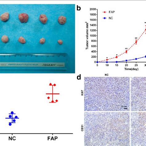 FAP Promotes GC Progression In A Xenograft Gastric Cancer Nude Mouse