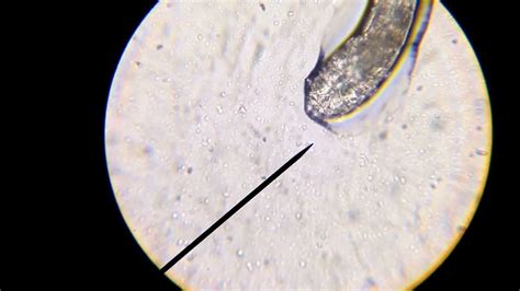 Demodex (mite from eyelash follicle) crawling on microscope slide ...