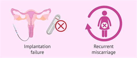 Recurrent Miscarriage Art Compass Ivf Lab Management Software