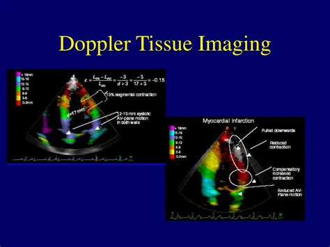 Ppt Principles Of Medical Ultrasound Powerpoint Presentation Free Download Id 3542489