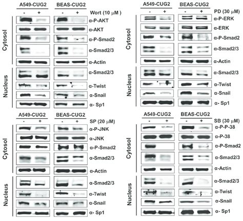 Treatment With Akt Or Mapk Inhibitors Diminishes The Cug Mediated