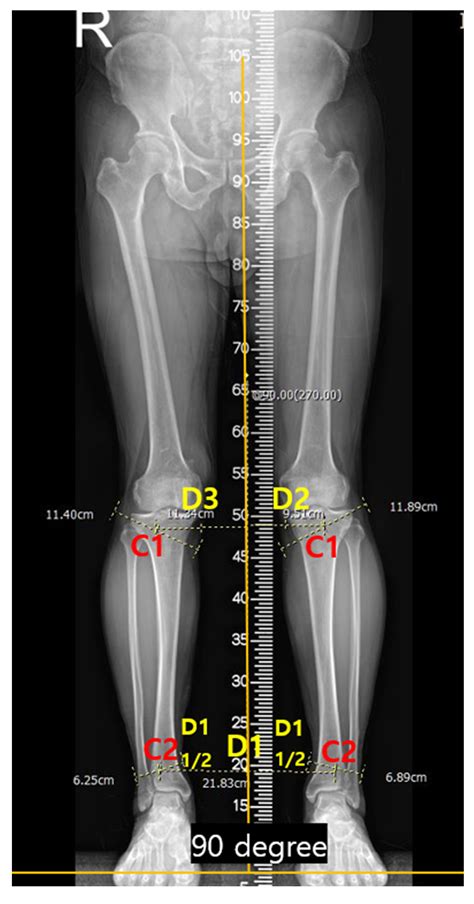 Applied Sciences Free Full Text Measurement Of Lower Extremity