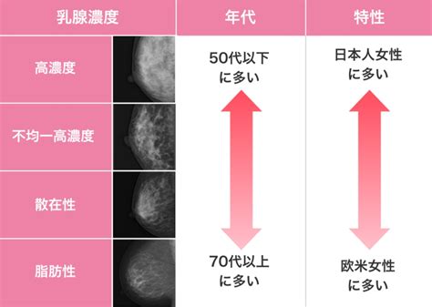 無痛mri乳がん検診 清恵会健診センター