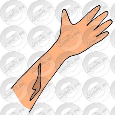 Scar Picture for Classroom / Therapy Use - Great Scar Clipart