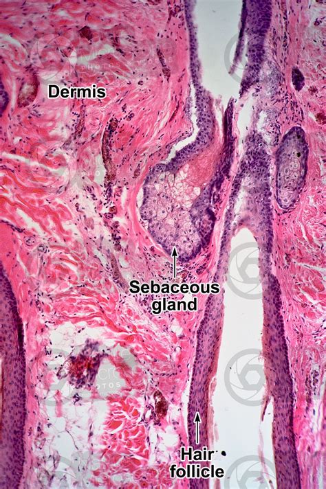 Man Sebaceous Gland Vertical Section X Sebaceous Gland