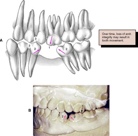 3 Treatment Planning Pocket Dentistry