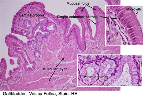 Gallbladder Histology Labeled