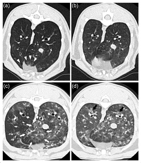 Thin Section Computed Tomography Ct Images Obtained In Mesenchymal Download Scientific