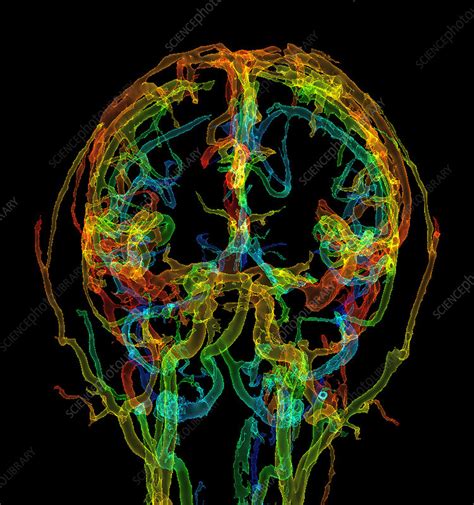 Head Blood Vessels 3d Ct Angiogram Stock Image C0490215 Science