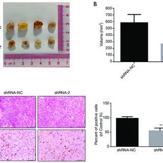 The Effect Of Knocking Down Of LncRNA ARAP1 AS1 On The Growth Of Lung