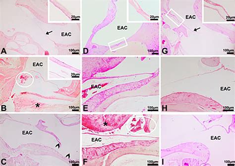 Histological Study Of The Healing Of Traumatic Tympanic Membrane