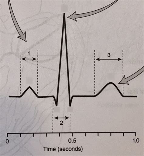 Ecg Graph Label The Waves Quiz Diagram Quizlet Hot Sex Picture