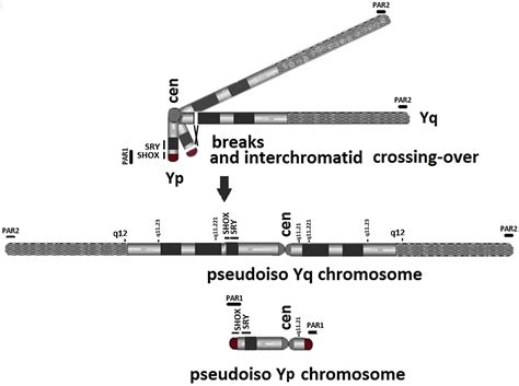 Fish And Array Cgh Characterization Of De Novo Derivative Y Chromosome