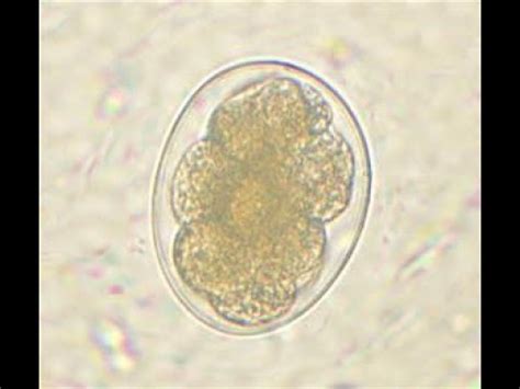 Hookworm Eggs Under Microscope