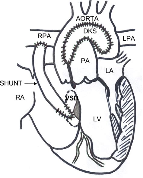 Chambers Of The Heart Coloring Pages