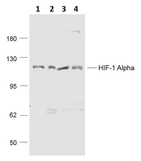 Anti Hif Alpha Antibody Ab Abcam