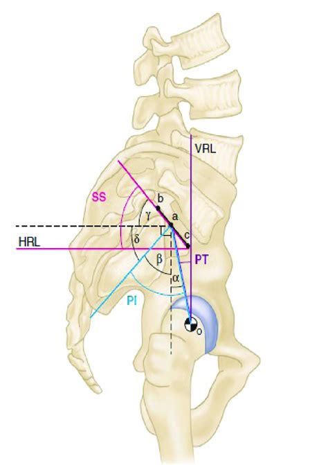 Spinopelvic Parameters Vrl Vertical Reference Line Hrl Horizontal