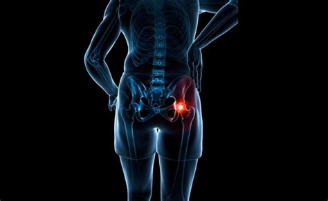 Hip Pain Curezone Physiotherapy