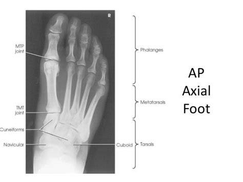 All Projections Anatomy