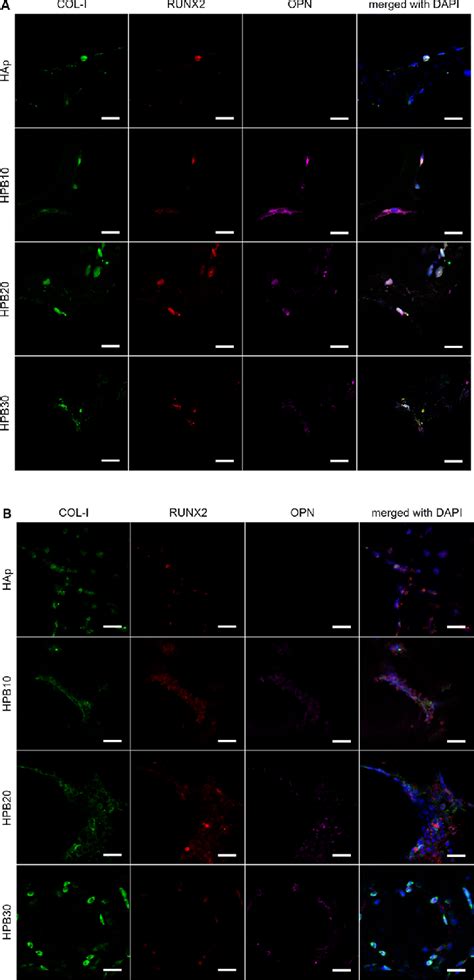 Osteogenic Activity Of Mc3t3 E1 Cells Cultured On Hap And Hpb Scaffolds