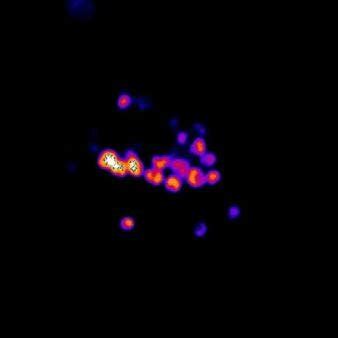 Synechococcus (each cell 1μm), taken using a laser confocal microscope ...