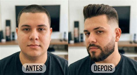 Visagismo Masculino Antes E Depois