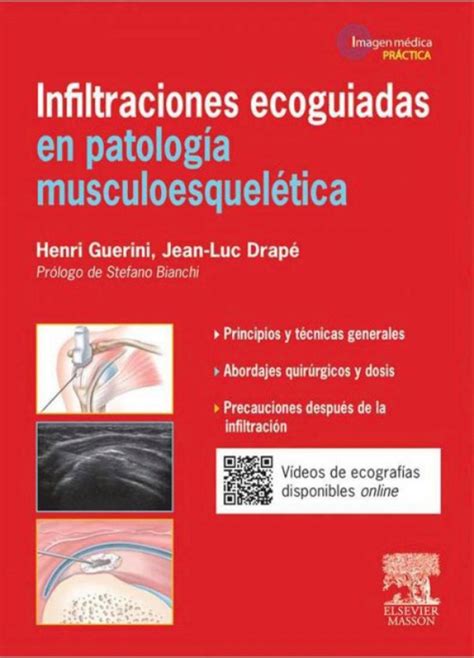 Infiltraciones Ecoguiadas En Patolog A Musculoesquel Tica Ebook En Laleo