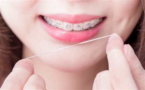 A Step by Step Helpful Guide to Flossing With Braces