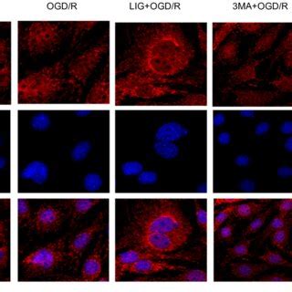 LIG Increases The Formation Of Autophagosomes In OGD R Exposed PC12