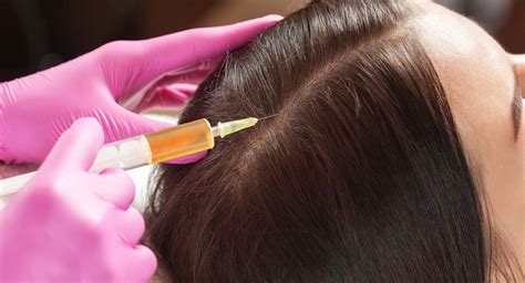 PRP for Hair Regrowth Long Beach | Heller Dermatology and Aesthetic Surgery