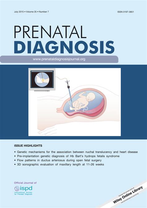 A First Look At Womens Perspectives On Noninvasive Prenatal Testing To