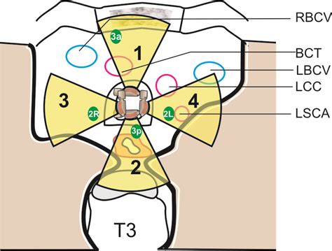 Techniques Of Linear Endobronchial Ultrasound Intechopen