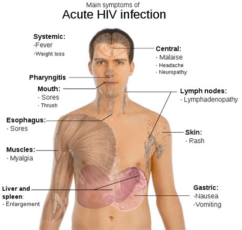 Hiv Lymph Nodes Neck