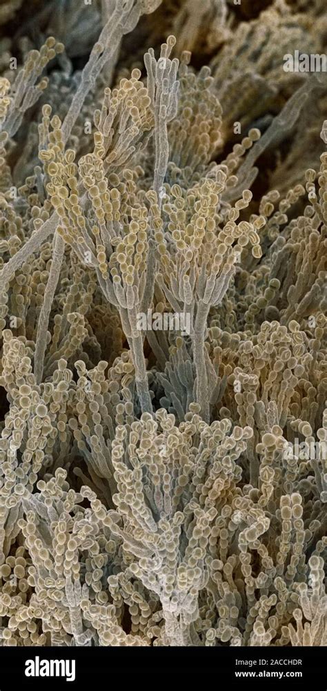 Penicillium Fungal Spores Coloured Scanning Electron Micrograph Sem