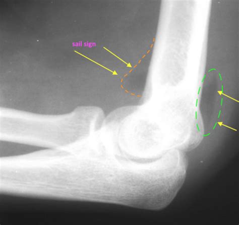 Diagnostic Imaging Exam Flashcards Quizlet