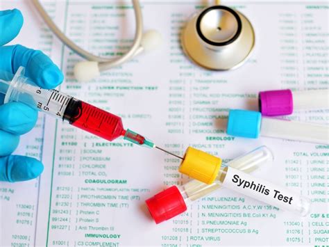 Syphilis 101: Symptoms, Causes, Diagnosis & Treatment - Homage Malaysia