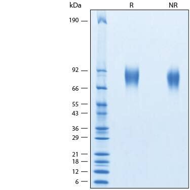 Recombinant Cynomolgus Rhesus Macaque Trka His Protein Cf Tk