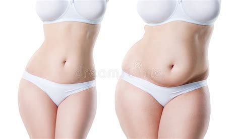 Cuerpo Del S De La Mujer Antes Y Después De La Pérdida De Peso