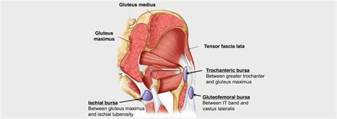 HIP BURSITIS MOTUS Physical Therapy