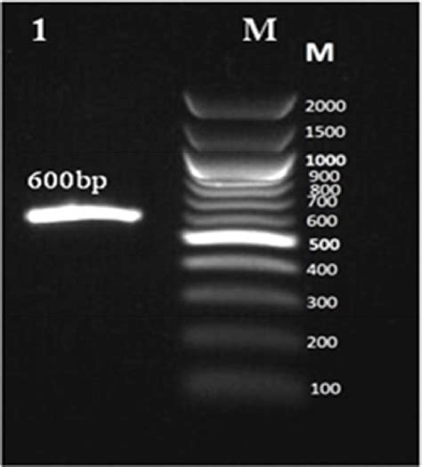 Agarose Gel Electrophoresis For Pcr Product 600 Bp Of Its Region From