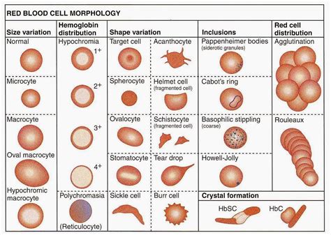 Medical Laboratory and Biomedical Science: Red Blood Cell Morphology ...